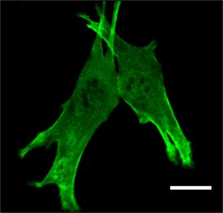 GFP-transfected myoblast cell